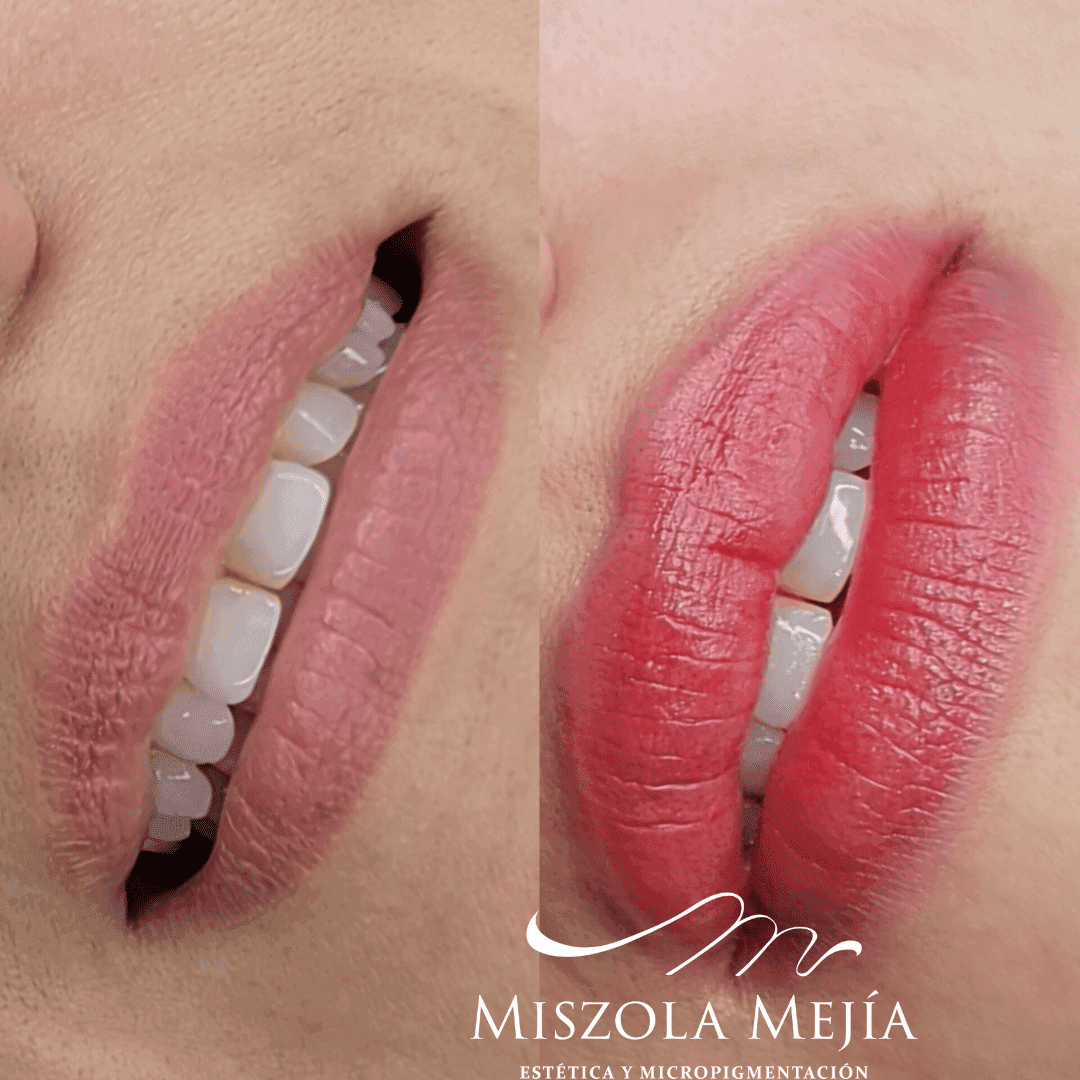 Labial Misz
