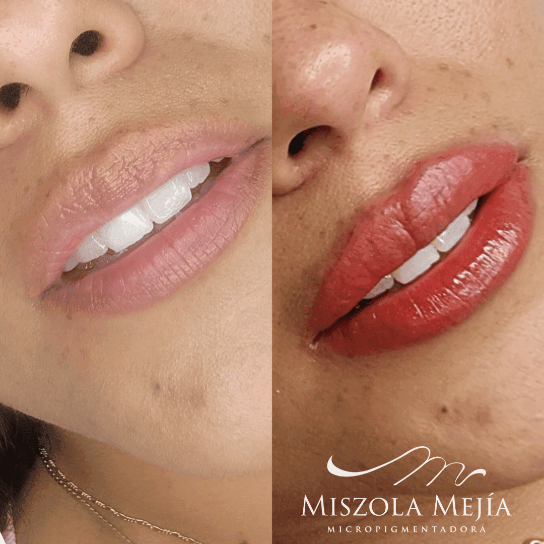 Labial Misz