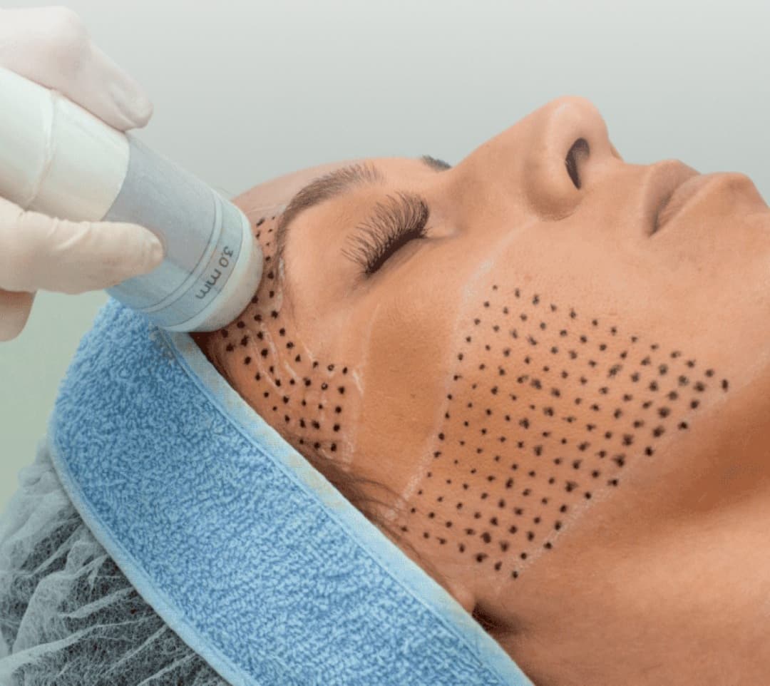 Casos de éxito Misz Estética